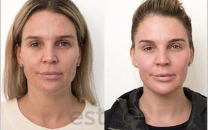 Thumbnail for Dubai Beauty Guide: Secrets to Healthy Skin in the UAE